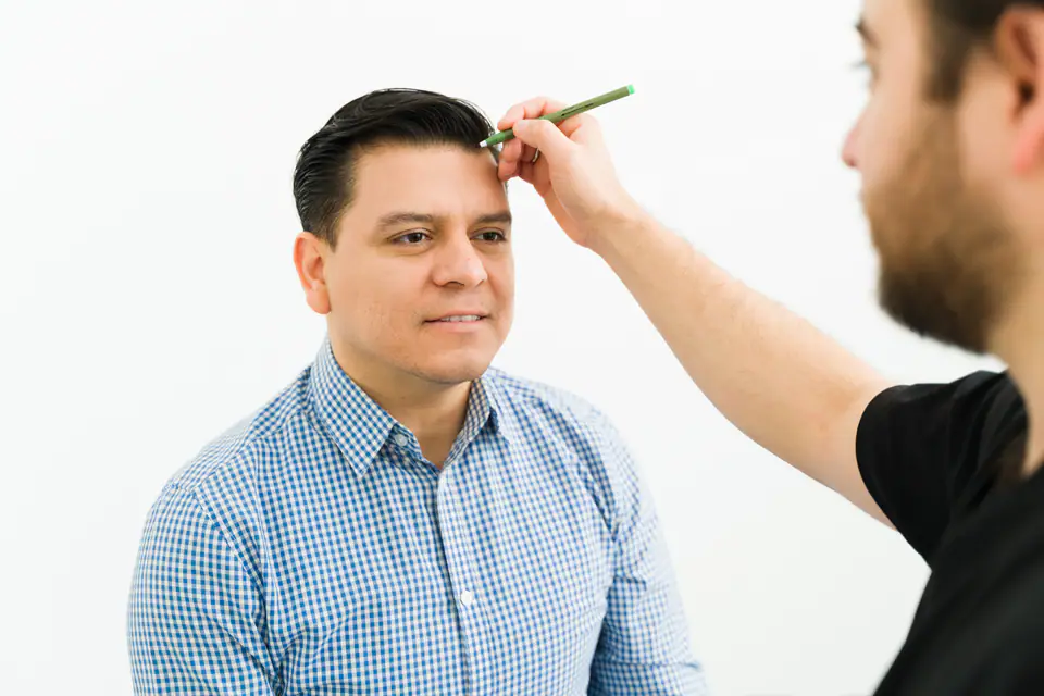 El doctor traza el diseño de la línea frontal natural antes de un injerto capilar